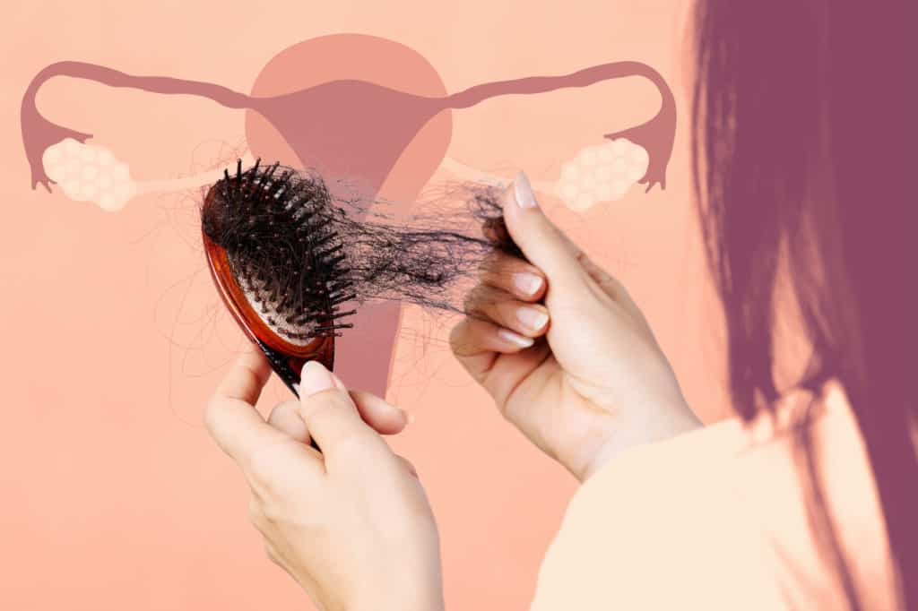 How To Reduce PCOS Hair Loss